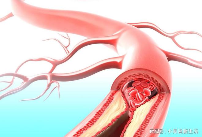 胃病不行吃苹果？大夫：若念爱护胃这3种生果尽量天博电竞网站少吃些(图6)